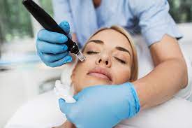 Renue MedSpa – Vancouver’s Trusted Microneedling Experts