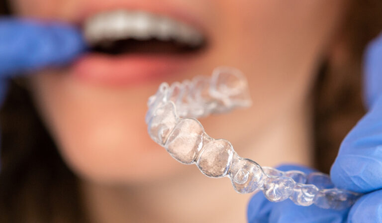 11 Common Myths About Invisalign in Penang – Debunked